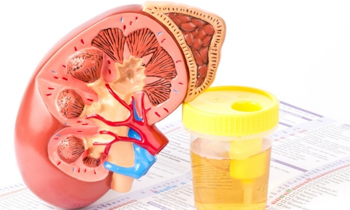 ไตติดเชื้อ (การติดเชื้อระบบทางเดินปัสสาวะ)