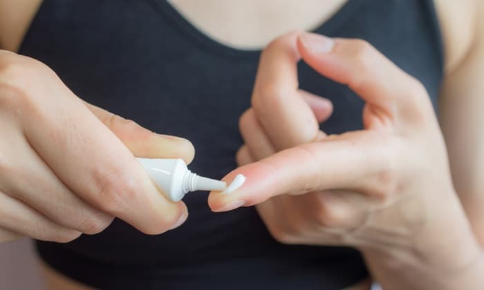 ไมโคนาโซล (Miconazole)