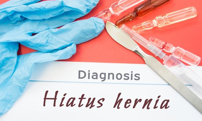 ไส้เลื่อนกระบังลม (hiatal hernia)