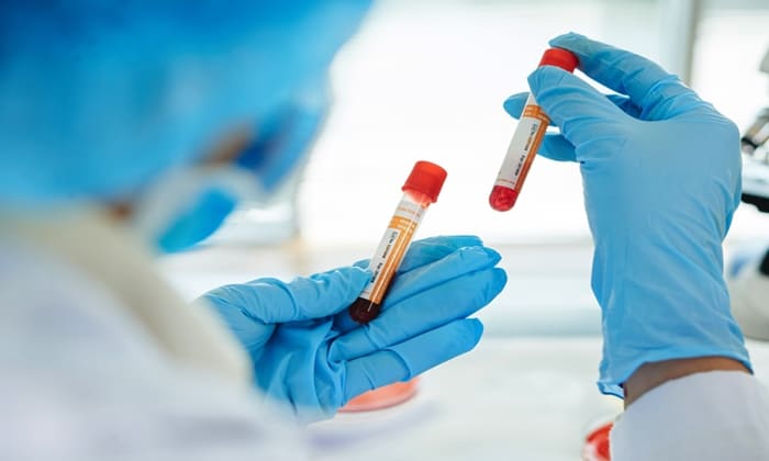 ตรวจคาร์บอนมอนอกไซด์ในเลือด (Carbon Monoxide Blood Test)