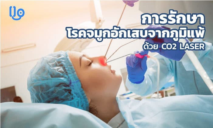การรักษา โรคจมูกอักเสบจากภูมิแพ้ ด้วย CO2 LASER