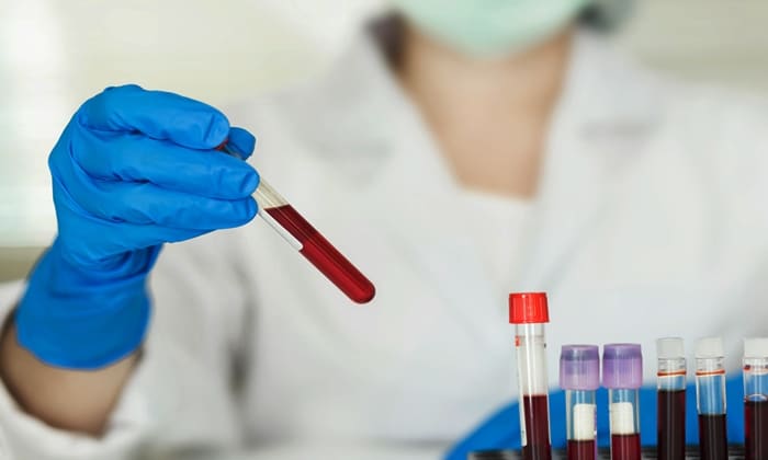 ตรวจค่าน้ำตาลสะสมในเลือด (Glycohemoglobin Test)