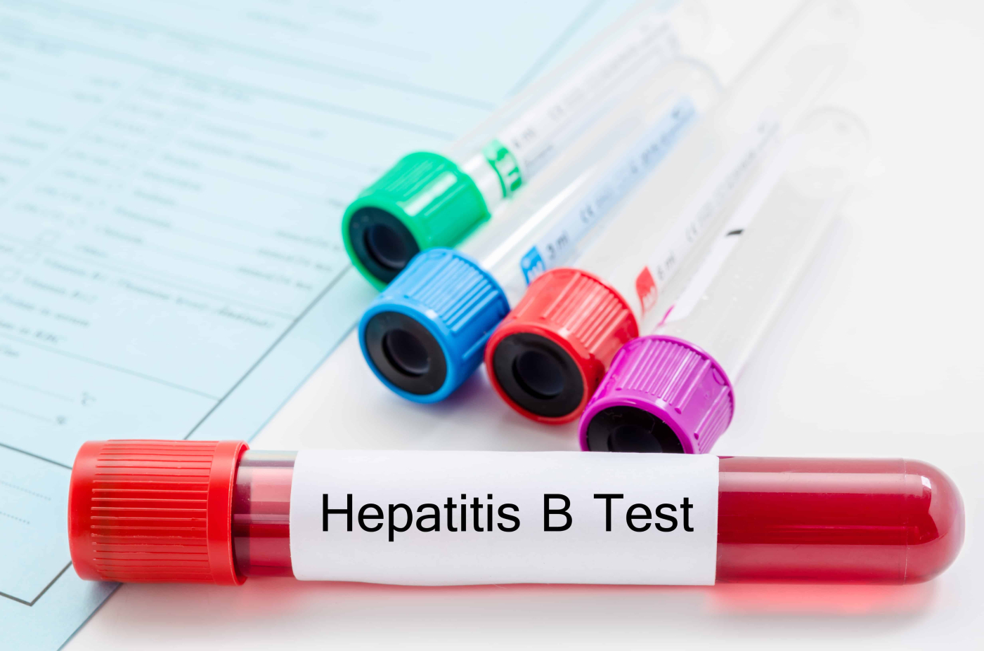 ตรวจไวรัสตับอักเสบบี (Hepatitis B Test)