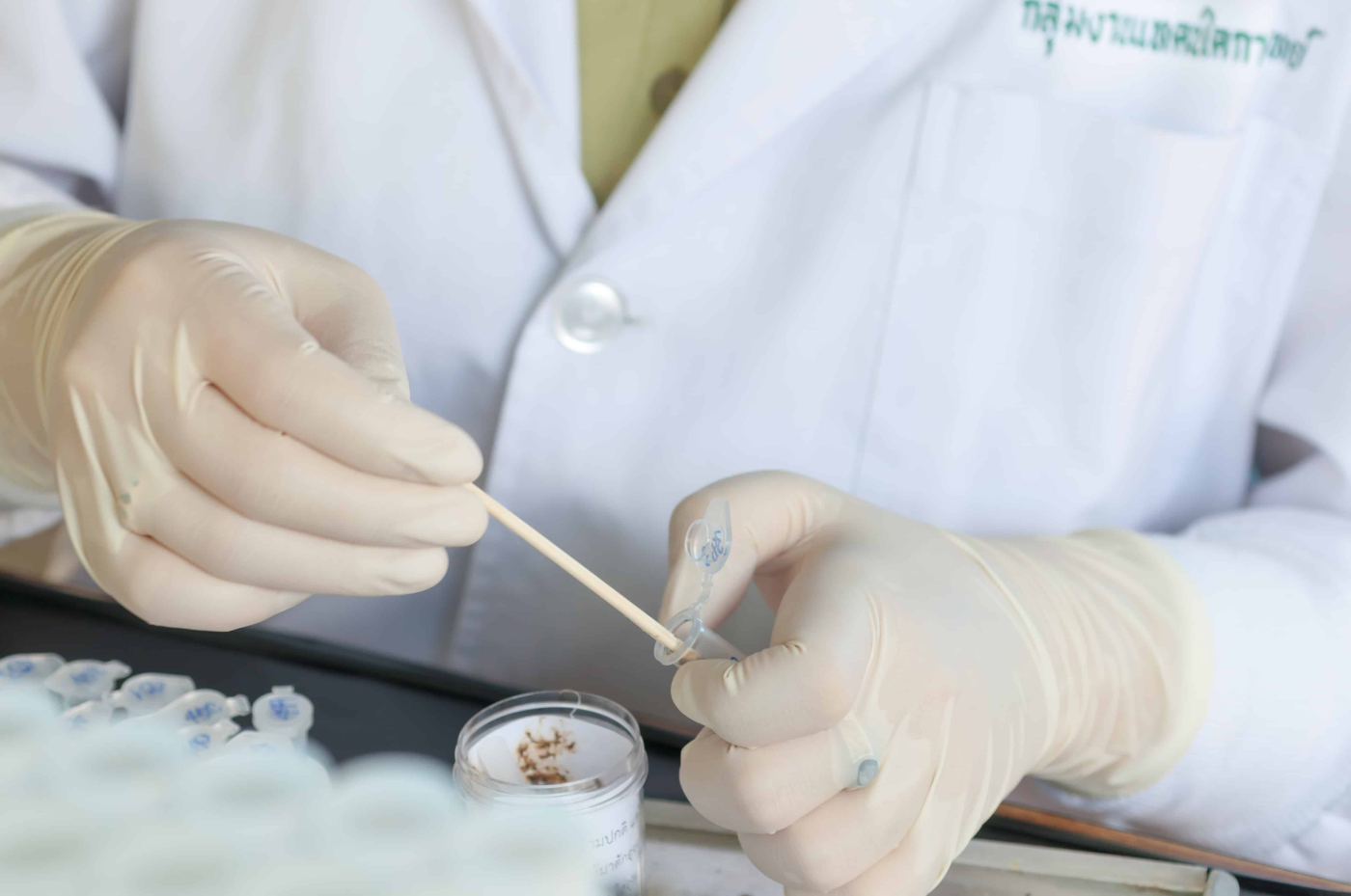 ตรวจอุจจาระ (Stool Analysis)