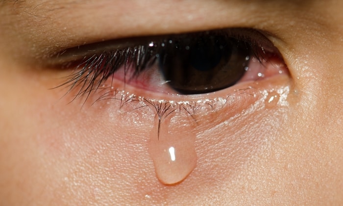 สารพันปัญหาที่ทำให้คุณ น้ำตาไหลตลอดเวลา โดยไม่ได้ร้องไห้!