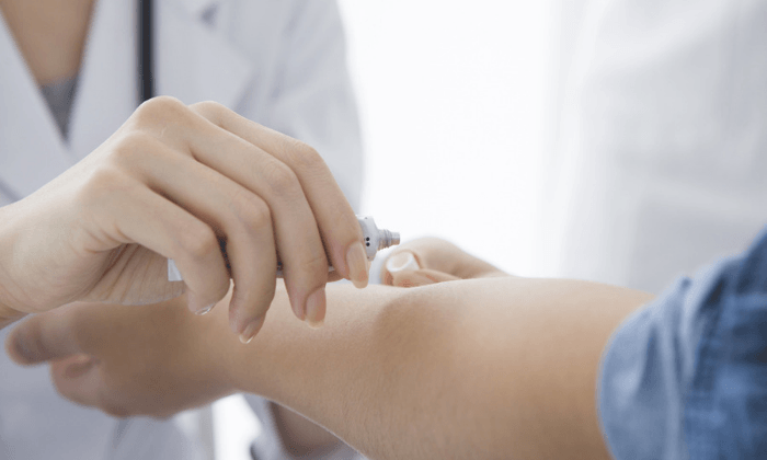 ข้อควรรู้ก่อนใช้ ยาคอร์ติโคสเตียรอยด์เฉพาะที่