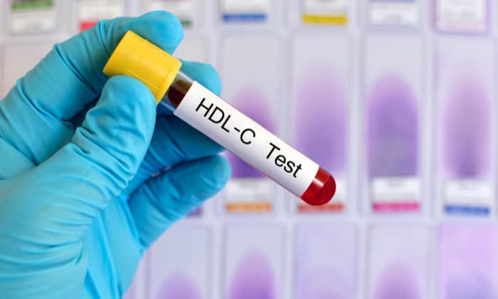 ตรวจวัดปริมาณไขมันดี (HDL Cholesterol Test)