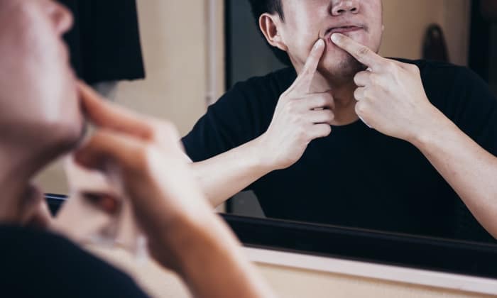 สิวหาย เพียงหลีกเลี่ยงพฤติกรรมเหล่านี้