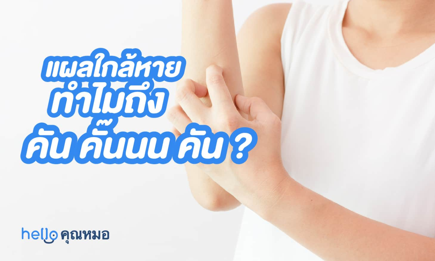 แผลที่ใกล้หาย ทำไมถึงคัน-คั้น-คัน?!