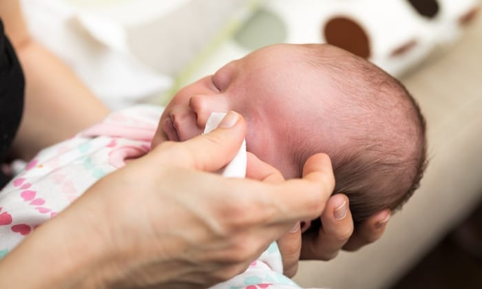 สิ่งที่ควรรู้เกี่ยวกับ ท่อน้ำตาอุดตัน ทารก