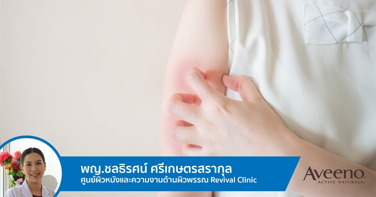 โรคผิวหนังอักเสบ (Eczema) แท้จริงเกิดจากอะไร