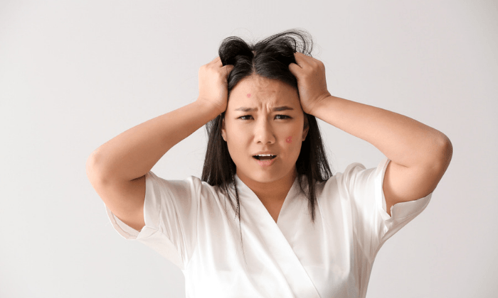 สิวกับความเครียด เกี่ยวข้องกันอย่างไร เครียดแล้วสิวขึ้นจริงหรือ?