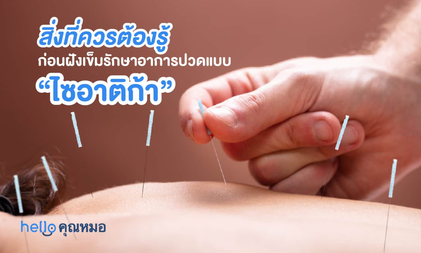 สิ่งที่คุณควรต้องรู้ ก่อนฝังเข็มรักษาอาการปวดแบบ "ไซอาติก้า"