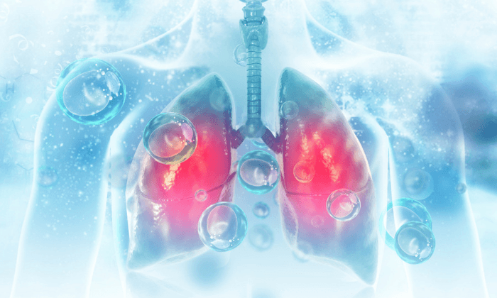 มาทำความรู้จักกับ มะเร็งปอดชนิดเซลล์ขนาดเล็ก (Small Cell Lung Cancer) กันเถอะ