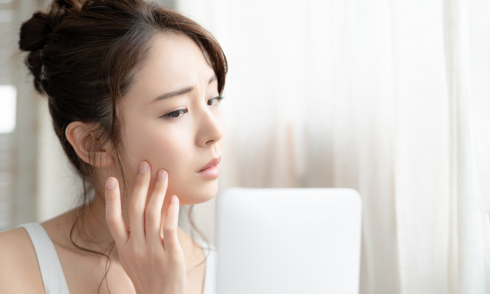 สิวเชื้อรา สาเหตุ และการป้องกัน