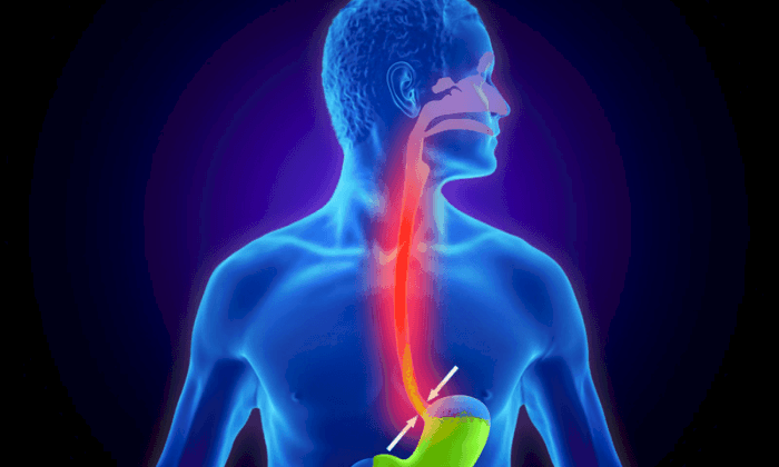 เปลี่ยนวิถีชีวิตง่ายๆ ป้องกันอาการกรดไหลย้อน