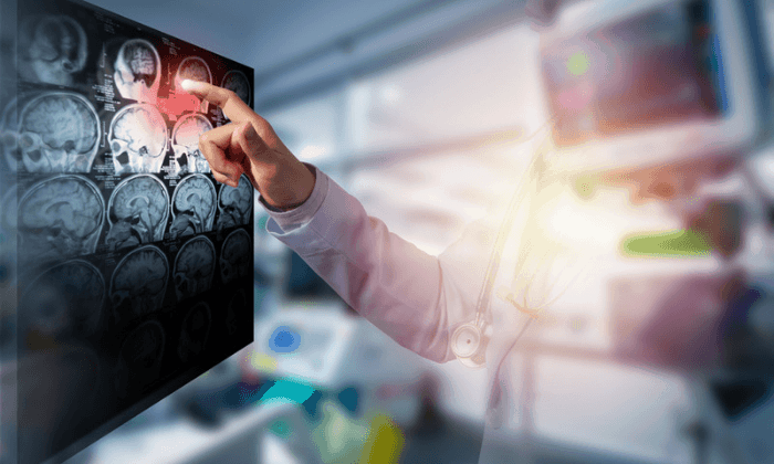 รวมเทคนิค และ วิธีรักษาภาวะสมองขาดเลือด ในนาทีฉุกเฉิน