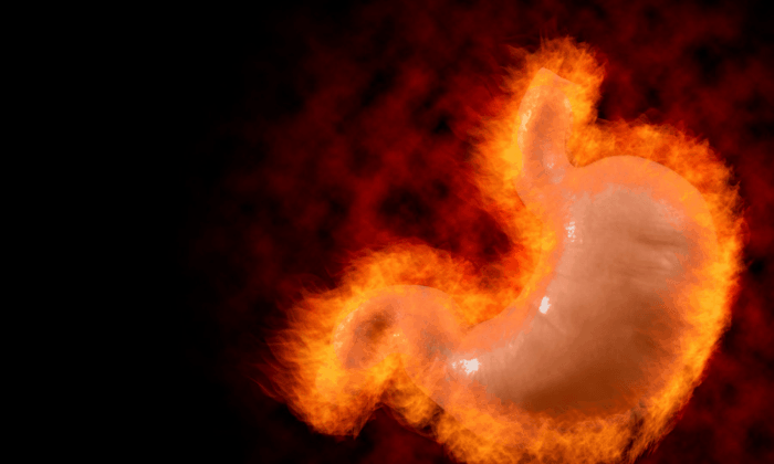 รักษากรดไหลย้อน ได้ง่ายๆ ด้วย 6 วิธีต่อไปนี้