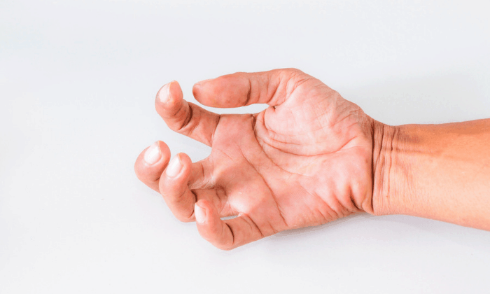 5 วิธีรับมือกับ กล้ามเนื้อหดเกร็ง จากโรคหลอดเลือดสมอง