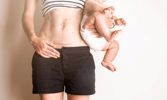 หลังผ่าคลอด มีอะไรกับแฟน ได้ตอนไหน และเมื่อไหร่ถึงจะตั้งครรภ์ได้