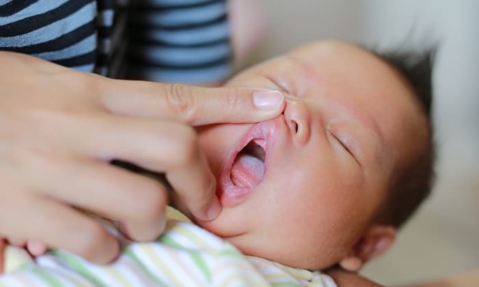 เด็กแรกเกิดปากแห้ง คุณพ่อคุณแม่มือใหม่ควรรับมืออย่างไรดี