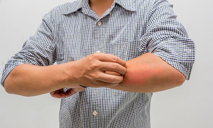 อาการคันในผู้ป่วยโรคเบาหวาน กับวิธีดูแลผิวให้ชุ่มชื้นและปลอดภัย