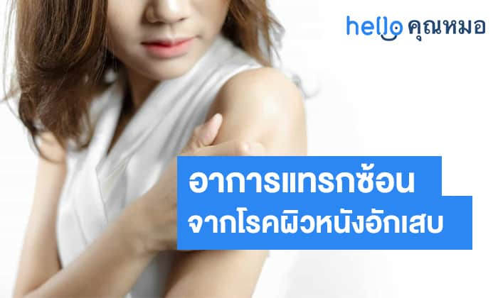 อาการแทรกซ้อนจากโรคผิวหนังอักเสบ