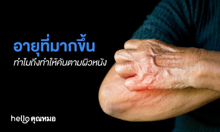 อายุที่มากขึ้น ทำไมถึงทำให้คันตามผิวหนัง