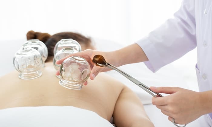 บำบัดอาการปวดเมื่อยด้วยการ ครอบแก้ว ฉบับศาสตร์จีน