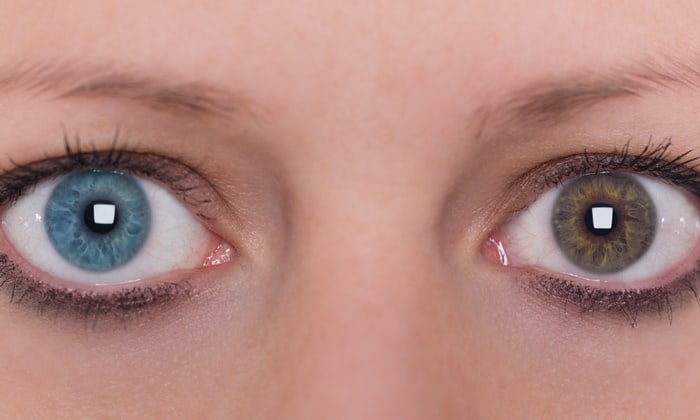 สีดวงตา สามารถบอกถึงความเสี่ยงด้านสุขภาพได้