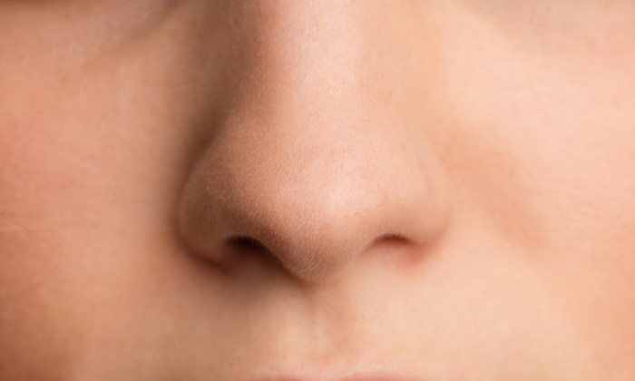 5 วิธีลดสิวเสี้ยน บริเวณจมูกให้หมดจด ด้วยวัตถุดิบรอบตัว