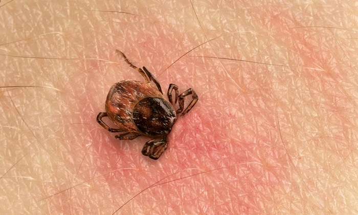 เห็บกัด อย่านิ่งนอนใจ เพราะอาจกลายเป็นโรคไลม์ (Lyme Disease) ได้โดยที่คุณไม่รู้ตัว
