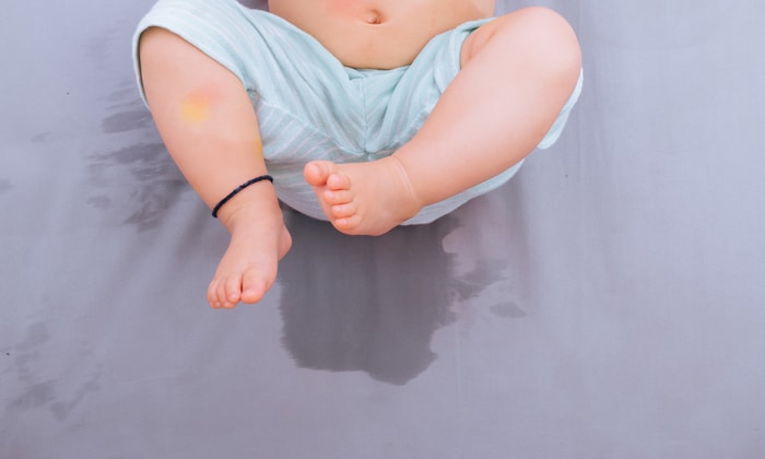 โรคฉี่หอม ในเด็กแรกเกิด สาเหตุ อาการ วิธีรักษา