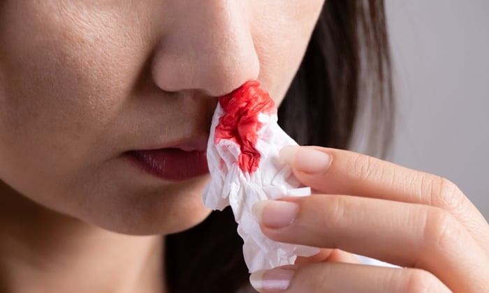 คนท้องเลือดกำเดาไหล อันตรายหรือไม่