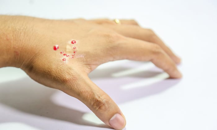 เตือนภัยนักสำรวจธรรมชาติ ระวัง โคโรนาไวรัส ที่อาจมาจากงู