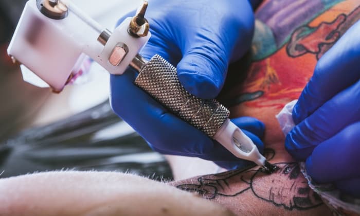 โรคสะเก็ดเงินกับการสัก เป็นโรคสะเก็ดเงิน สักได้ไหม