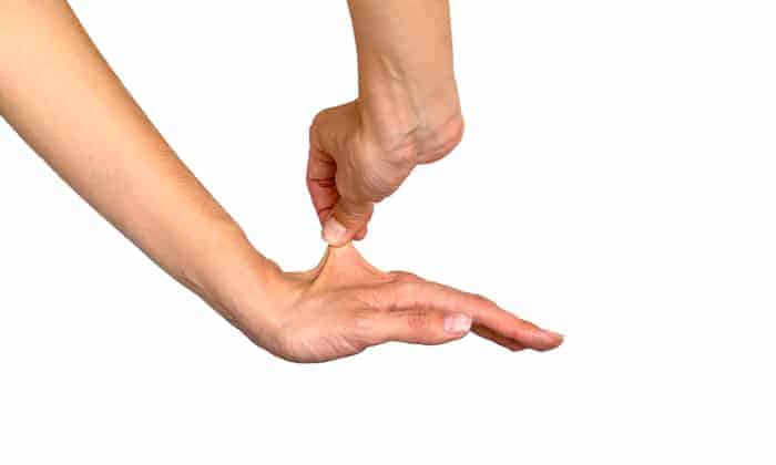 ทำความรู้จัก ตัวการ์ตูน ลูฟี่ วันพีช กับข้อสันนิษฐาน โรคหนังยืดผิดปกติ