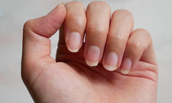 เล็บกับสุขภาพ รู้หรือไม่ สัญญาณเตือนโรคดูได้จากเล็บ