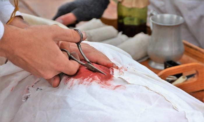 เมื่อถูกยิง ควรทำอย่างไร วิธีการปฐมพยาบาลเมื่อถูกยิง ที่ควรรู้