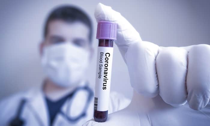 อัพเดตสถานการณ์ เหยื่อโควิด-19 ในไทย เสียชีวิตแล้วรายแรก