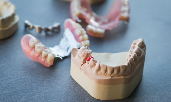 เหงือกดำ ทำเอาหมดความมั่นใจ เกิดจากอะไรและป้องกันยังไงได้บ้าง