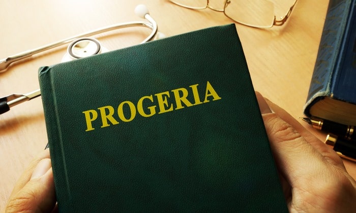 โรคโพรจีเรีย อาการ สาเหตุ การรักษา