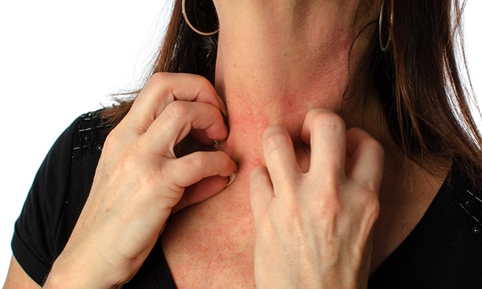 ทาครีมกันแดดแล้วแสบหน้า อาจ แพ้ครีมกันแดด