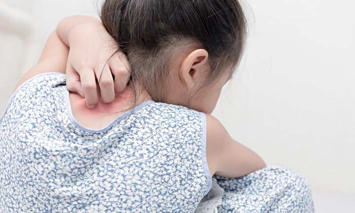 โรคดักแด้ ในเด็ก อาการ สาเหตุ วิธีดูแล