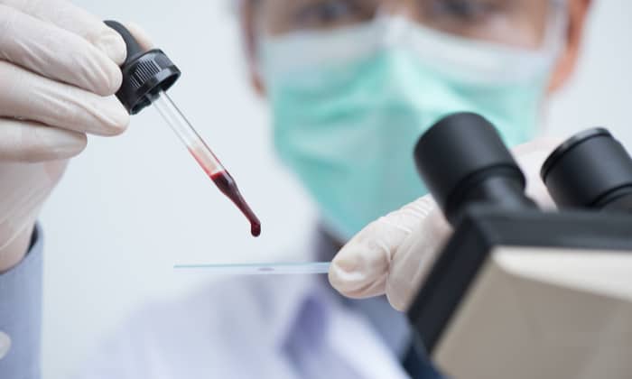 งานวิจัยจีนชี้! คน กรุ๊ปเลือดเอ อาจมีความเสี่ยงติดเชื้อ โควิด-19 ได้ง่ายที่สุด