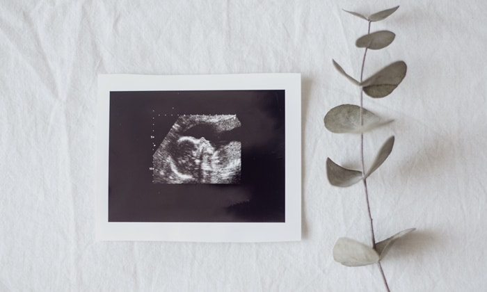 ความเสี่ยงของการทำแท้งเอง มีอะไรบ้าง