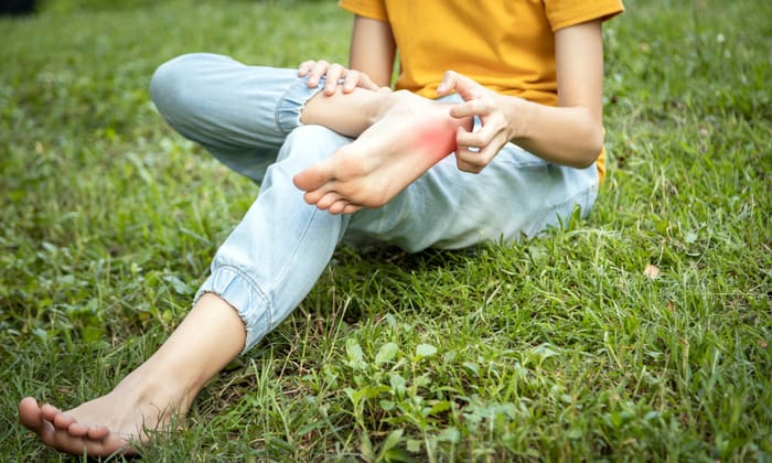 COVID Toe ผื่นแดงที่เท้า สัญญาณเตือนอีกอย่างของโควิด-19 ที่ควรสังเกต