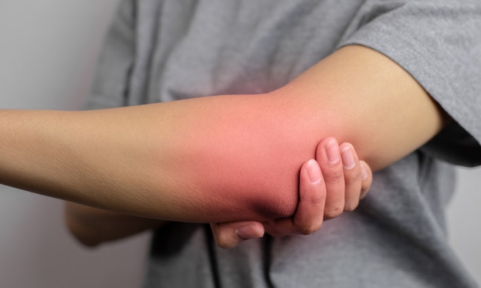 อาการปวดข้อศอก เรื่องเล็กๆ แต่มาพร้อมกับอันตรายที่ไม่ควรมองข้าม