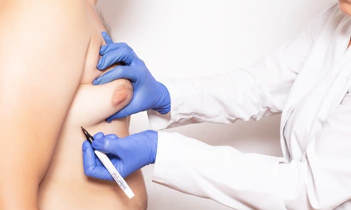 ภาวะเต้านมโตในผู้ชาย อาการ สาเหตุ การรักษา