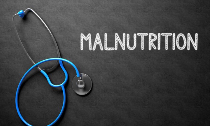 ภาวะทุพโภชนาการ อาการ สาเหตุ การรักษา